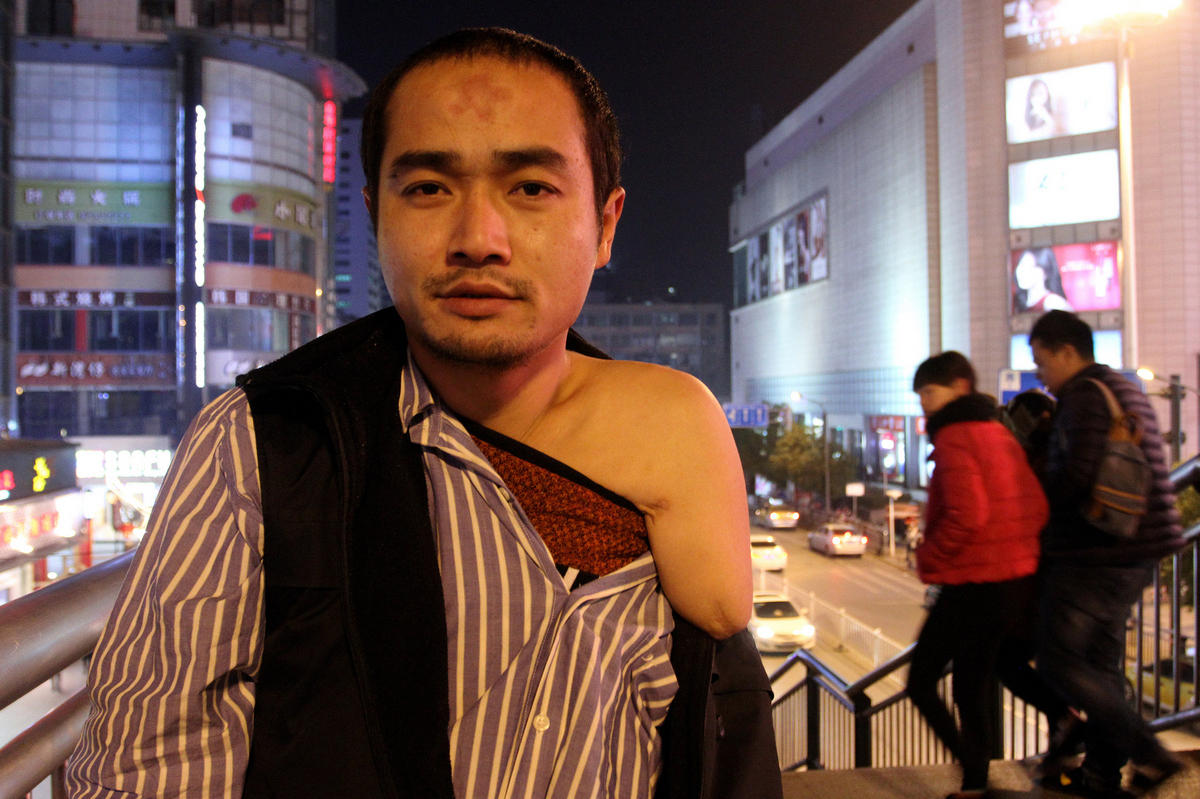 说起来，小黄也算命途多舛。还没懂事时，父亲就已生病离世；年幼时，自己双手也被高压电击伤，左手因此高位截肢，右手失去了大部分功能，如今连伸直都困难，更别提正常使用了。