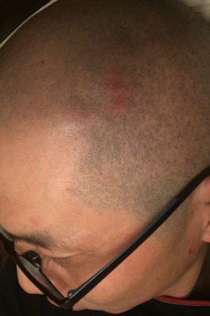 随后，陈先生报警，民警到店内调看监控录像，陈先生在吧台看监控被店家阻止，头部受伤。