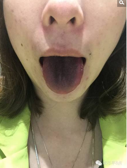 　　今天记者接到读者对苏州南门商圈黄门老灶火锅店一项投诉，读者爱米称在吃火锅时发现自己舌头变黑，后将菜品放锅中煮后全部变黑。而商家解释是铁锅原因，铁离子分离才导致汤汁、菜品发黑，对人体并无伤害。