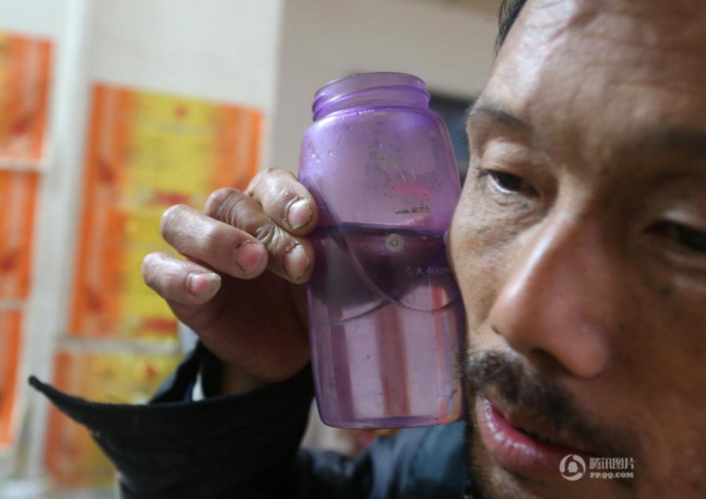 　　丈夫吕东玲用脸测试水温为妻子喂药。“村里人都夸我是好男人，我感觉是自己上辈子欠媳妇的。俩女儿现在大了也懂事了，上学回来都帮着干农活家务，妻子的病比以前好多了，最难的时候过去了，一家人坐在一起比什么都强”。吕东玲说。