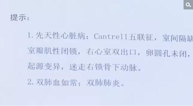　　其实在产检的时候，小宝父母已经知道小宝有先天性心脏病，但是为了大人和龙凤胎的平安，最后还是选择了生下来。妈妈说，因为小宝的心脏外露，只有一层薄薄的皮肤包住，所以在照顾小宝时非常小心翼翼，否则分分钟有危险。